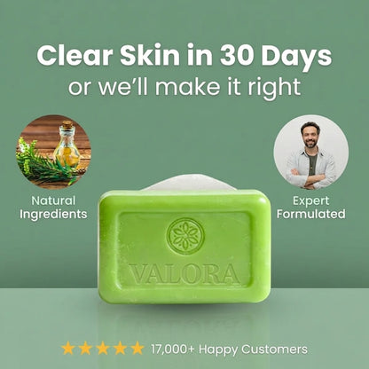 Valora Antifungal Soap