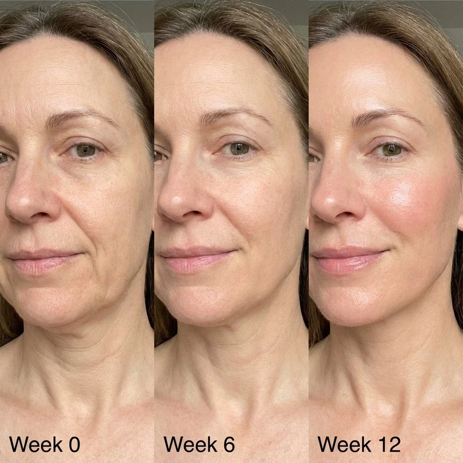 Before and after using Tallow and Honey Balm