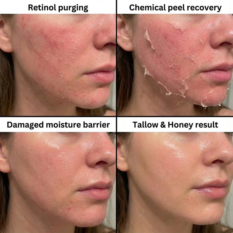 Before and after using Tallow and Honey Balm