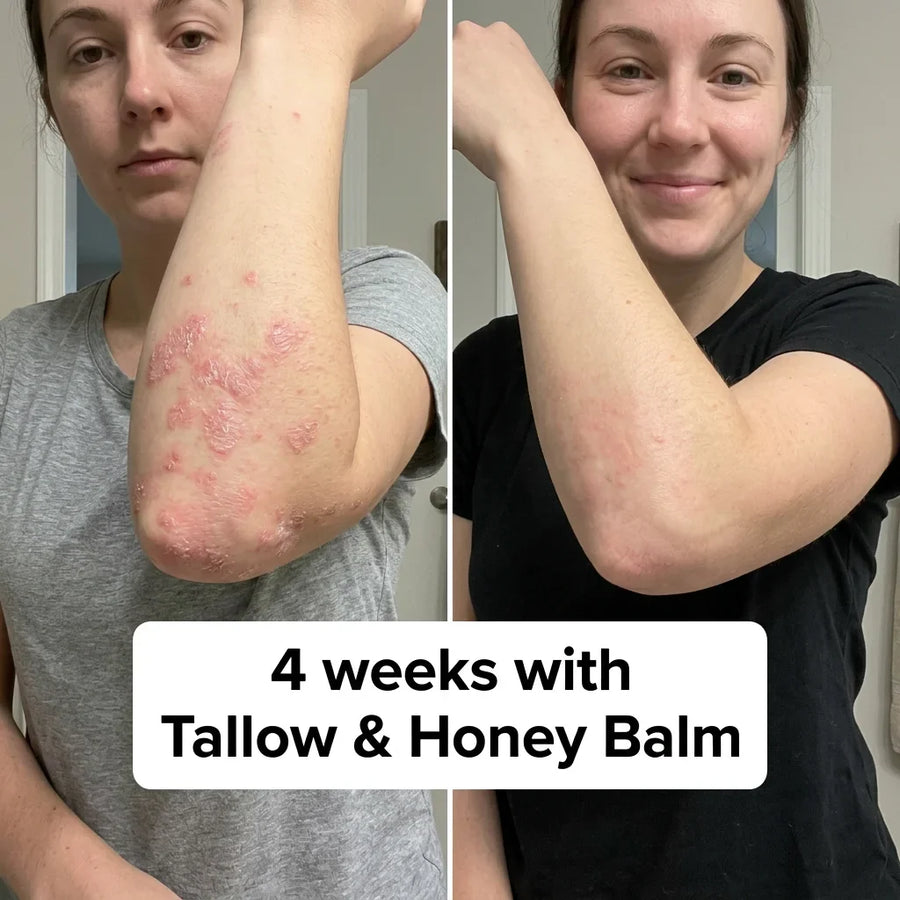 Before and after using Tallow and Honey Balm