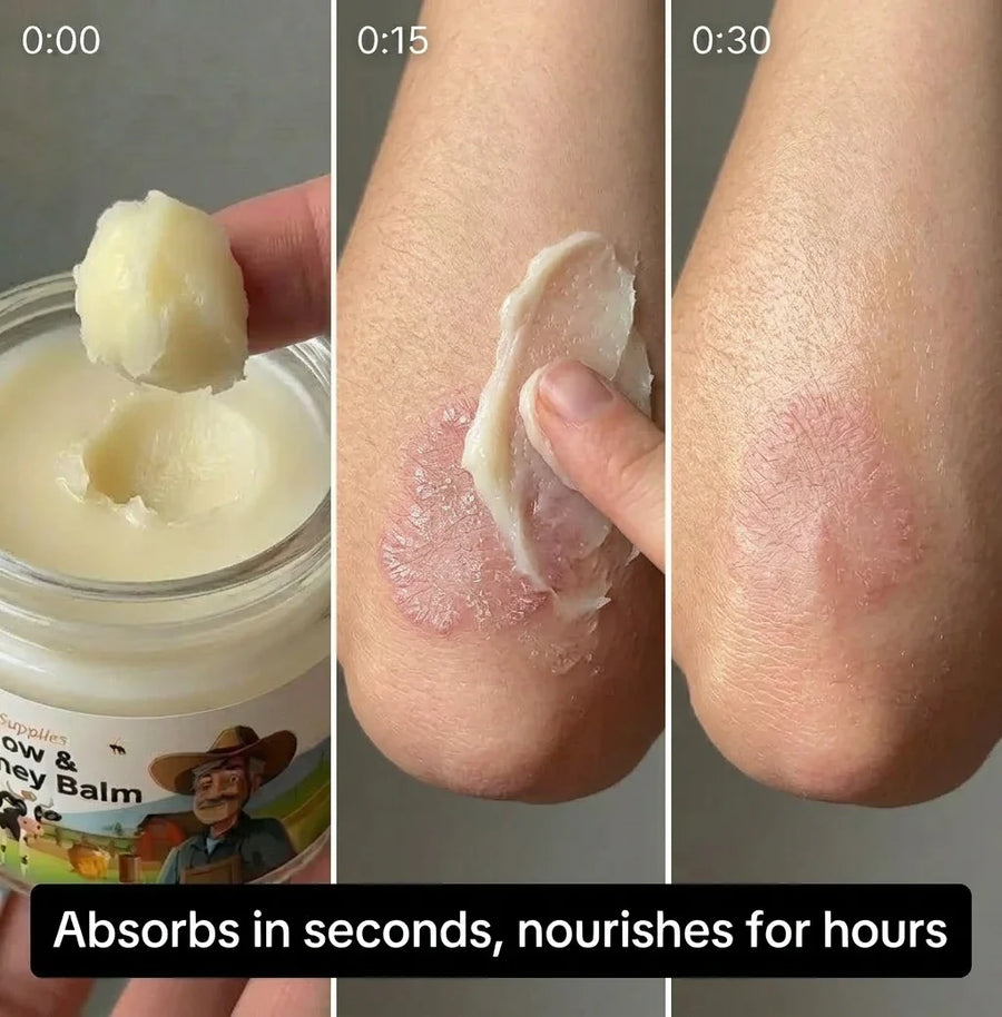 Before and after using Tallow and Honey Balm