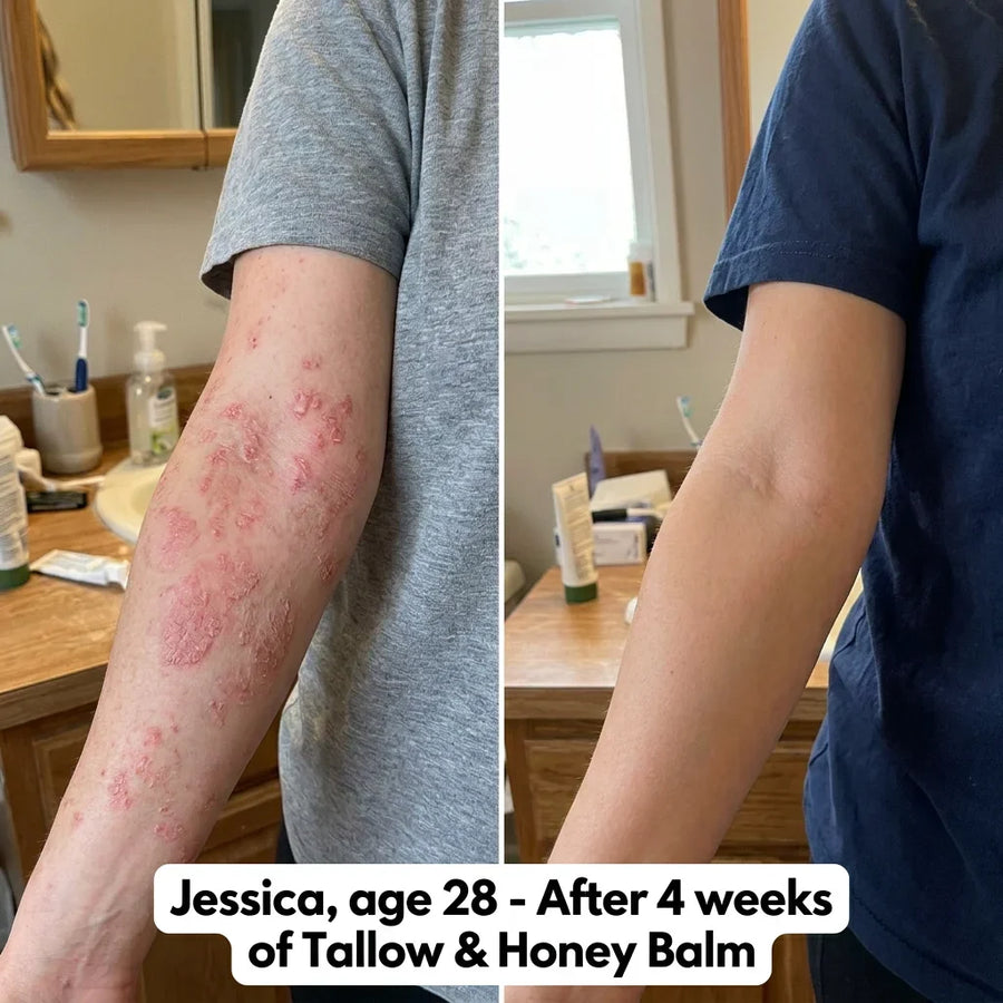 Before and after using Tallow and Honey Balm