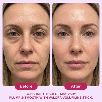 PDRN + NAD Volume Stick